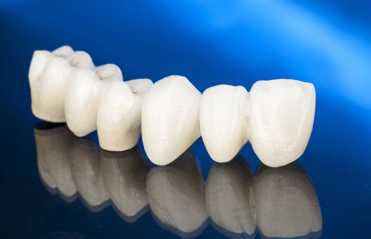 How Much Does A Dental Crown Cost?